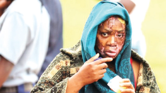 Jailed 10 years for acid attack on wife