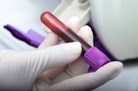 Teacher draws blood from students