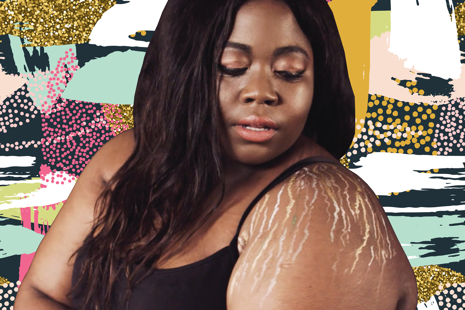 Think Twice! Doctor Advises Against Stretch Mark Removal Products